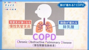 COPDとは